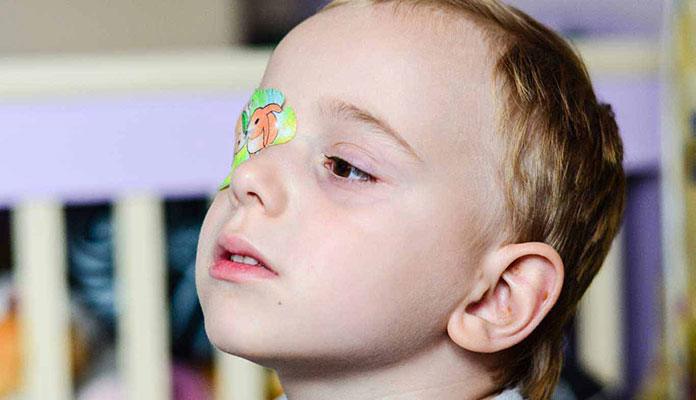 Facts about Lazy Eye (Amblyopia) in Children New Life