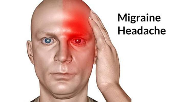 Migraine Tingling
