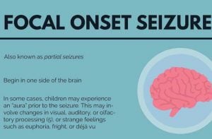Partial Seizures (Focal Seizures) Guide – 10 Facts to Know | New Life ...